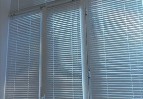 Рулонные шторы и жалюзи в проекте Горизонтальные алюминиевые жалюзи для стоматологии «Азур-Дент»